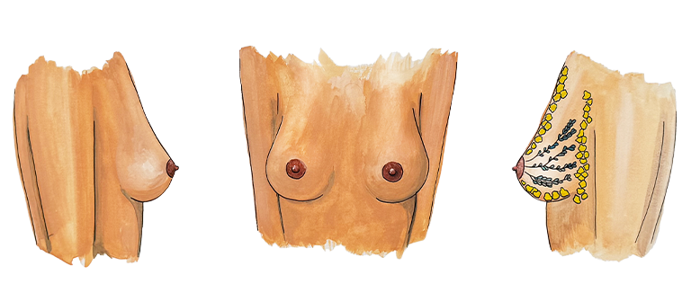 Dr. Pirkko Schuppan – Illustration von Tubulärer Brust Normal