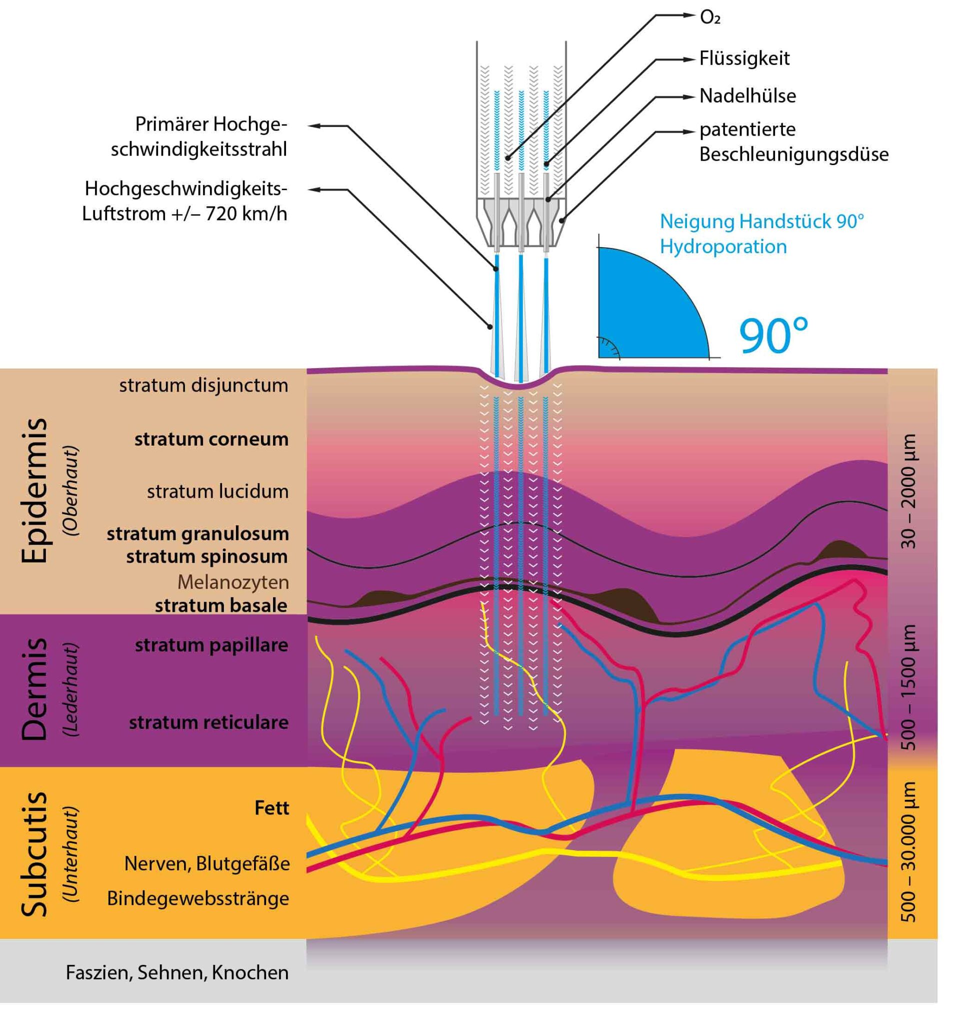 Schematische Darstellung eines Querschnitts durch die Hautschichten – Epidermis, Dermis und Subkutis –, die einem unter einem Winkel von 90° gerichteten Hochgeschwindigkeitswasserstrahl ausgesetzt sind. Die Beschriftungen veranschaulichen die Hautstrukturen und zeigen, wie die Hydrodermabrasion die Hautoberfläche für Behandlungen wie Botox vorbereitet.
